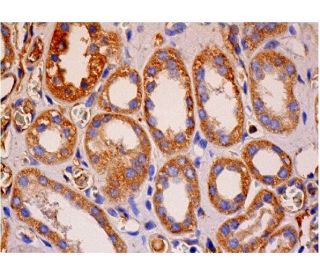 immunohistochemistry image from recommended TGF&alpha; (D-6) monoclonal antibody replacement. Image 286452