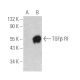TGF beta Receptor 1/TGFBR1 Antibody (B-7) - Western Blotting - Image 389909