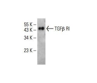 TGF beta Receptor 1/TGFBR1 Antibody (C-12) - Western Blotting - Image 394770