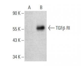 western blotting image from recommended TGF beta Receptor 1/TGFBR1 (D-1) monoclonal antibody replacement. Image 385935