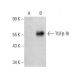 western blotting image from recommended TGF beta Receptor 1/TGFBR1 (D-1) monoclonal antibody replacement. Image 385935
