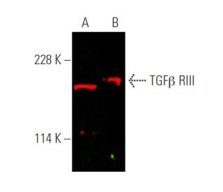 western blotting image from recommended TGF beta Receptor 3/TGFBR3 (A-4) monoclonal antibody replacement. Image 375702