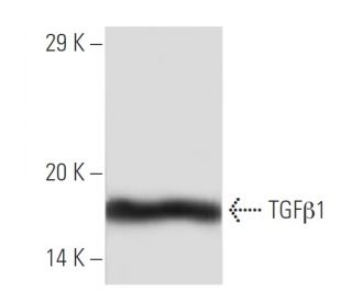 western blotting image from recommended TGF beta 1 (3C11) monoclonal antibody replacement. Image 136774