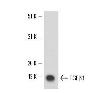 TGF beta 1 Antibody (TB21) | SCBT - Santa Cruz Biotechnology