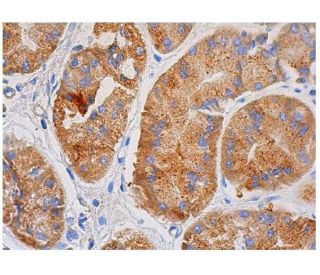 immunohistochemistry image from recommended TGF&beta;3 (G-9) monoclonal antibody replacement. Image 348764