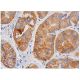This polyclonal antibody has been discontinued. See our recommended <a href="tgfbeta3-antibody-g-9">TGFβ3 (G-9)</a> monoclonal antibody (sample data shown). immunohistochemistry image from recommended TGFβ3 (G-9) monoclonal antibody replacement. Image 348764