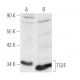 TGIF Antibody (H-1) - Western Blotting - Image 1584 