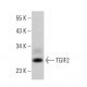 TGIF2 Antibody (G-10) - Western Blotting - Image 380853