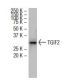 TGIF2 Antibody (H-36) - Western Blotting - Image 33642