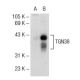 TGN38 Antibody (A-5) - Western Blotting - Image 72758