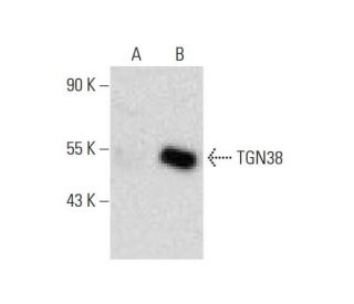TGN38 Antibody (G-9) - Western Blotting - Image 135242