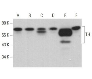 Tyrosine Hydrolase Antibody (A-1) - Western Blotting - Image 380468 