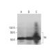 This polyclonal antibody has been discontinued. See our recommended <a href="th-antibody-f-11">Tyrosine Hydrolase (F-11)</a> monoclonal antibody (sample data shown). western blotting image from recommended Tyrosine Hydrolase (F-11) monoclonal antibody replacement. Image 352018