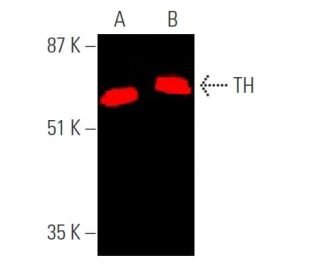 Tyrosine Hydrolase Antibody (F-11) - Western Blotting - Image 374281 