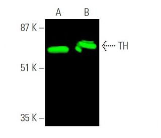 Tyrosine Hydrolase Antibody F 11 SCBT Santa Cruz Biotechnology