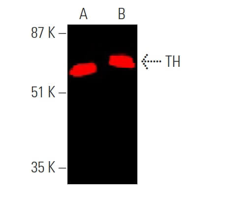 Tyrosine Hydrolase Antibody F 11 Santa Cruz Biotechnology