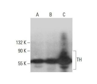 western blotting image from recommended Tyrosine Hydrolase (F-11) monoclonal antibody replacement. Image 352018