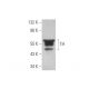Tyrosine Hydrolase Antibody (TOH A1.1) - Western Blotting - Image 352770