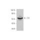 Tyrosine Hydrolase Antibody (TOH A1.1) - Western Blotting - Image 352771 