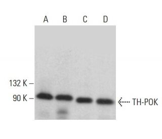 TH-POK Antibody (A-4) - Western Blotting - Image 376274 
