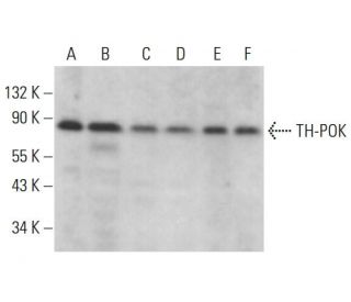 TH-POK Antibody (C-8) - Western Blotting - Image 376271 