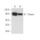 Themis Antibody (A-11) - Western Blotting - Image 372856