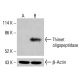 Anticorpo anti-thimet oligopeptidase (D-10): sc-377153. Análise por Western blot da expressão da thimet oligopeptidase em lisados celulares completos K-562 não tratados (A) e tratados quimicamente (B). Reagente de deteção utilizado: m-IgGκ BP-HRP: sc-516102. β-Actina (C4): sc-47778 utilizado como controlo de carregamento. Reagente de deteção utilizado: m-IgG Fc BP-HRP: sc-525409. Thimet oligopeptidase Antibody (D-10) - Western Blotting - Image 414914