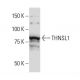 THNSL1 Antibody (77-Y) - Western Blotting - Image 33960