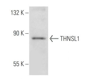 THNSL1 Antibody (77-Y) - Western Blotting - Image 48675 