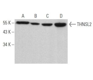 THNSL2 Antibody (B-4) - Western Blotting - Image 373210 