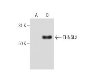 THNSL2 Antibody (D-8) - Western Blotting - Image 288971