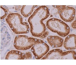 immunohistochemistry image from recommended THP (B-2) monoclonal antibody replacement. Image 370360
