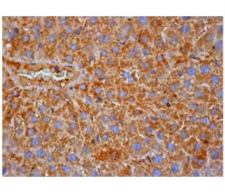 Thrombin Antibody (F-1) | SCBT - Santa Cruz Biotechnology