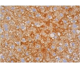 thrombin-antibody-f-1-