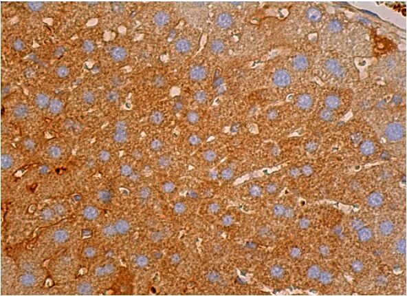 Thrombin Antibody (F-1) | SCBT - Santa Cruz Biotechnology