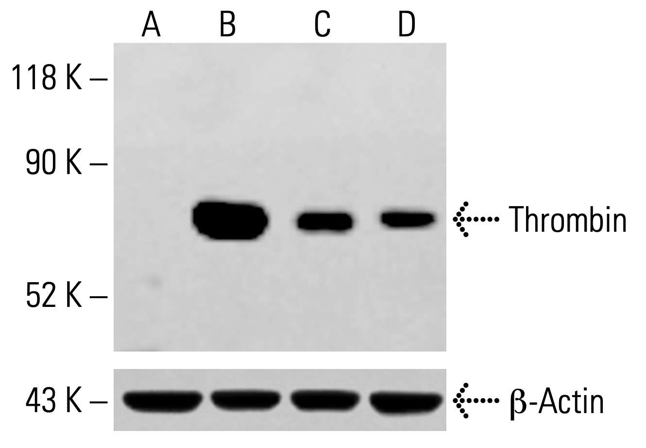 ふい〰️ん Thrombin Antibody (F-1) | SCBT - Santa Cruz Biotechnology