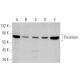 western blotting image from recommended Thrombin (F-1) monoclonal antibody replacement. Image 355308