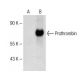 Thrombin API Antibody (B-2) - Western Blotting - Image 150622