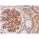 이 다클론 항체는 생산이 중단되었습니다. 권장 <a href="thrombin-r-antibody-atap2">Thrombin R (ATAP2)</a> 단클론 항체(샘플 데이터 표시)를 참조하세요. immunohistochemistry image from recommended Thrombin R (ATAP2) monoclonal antibody replacement. Image 361363