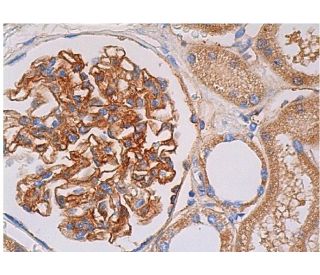 immunohistochemistry image from recommended Thrombin R (ATAP2) monoclonal antibody replacement. Image 361363