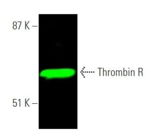 Thrombin R Antibody (ATAP2) - Western Blotting - Image 375306