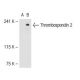 Thrombospondin 1/2 Antibody (D-9) - Western Blotting - Image 40194 