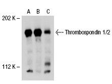 Thrombospondin 1/2 Antibody (G-1) | SCBT - Santa Cruz Biotechnology