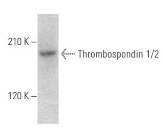 ほぐも Thrombospondin 1/2 Antibody (G-1) | SCBT - Santa Cruz Biotechnology