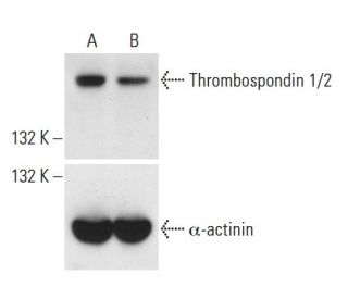 Thrombospondin 1 siRNA (h): sc-36665. Western blot analysis of Thrombospondin 1 expression in non-transfected control (A) 