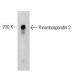 Thrombospondin 2 Antibody (4) - Western Blotting - Image 127529
