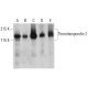 Thrombospondin 2 Antibody (4) - Western Blotting - Image 386074 