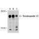 western blotting image from recommended Thrombospondin 1/2 (G-1) monoclonal antibody replacement. Image 30323