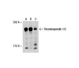 western blotting image from recommended Thrombospondin 1/2 (G-1) monoclonal antibody replacement. Image 30323