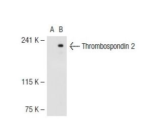 Thrombospondin 1/2 Antibody (D-9) - Western Blotting - Image 40194